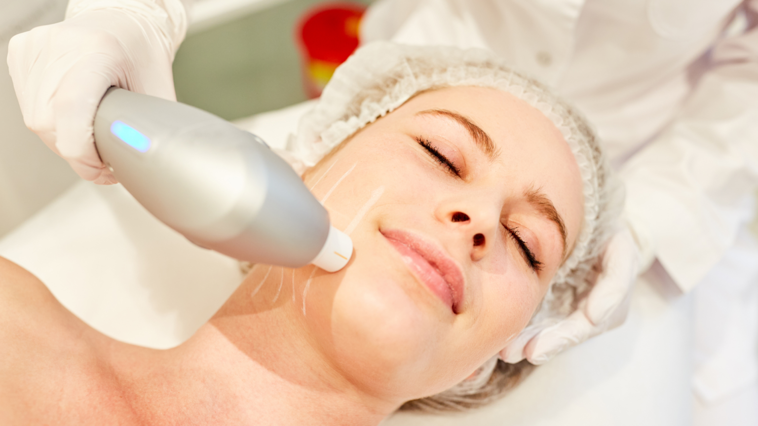 Radiofrequency Skin Tightening ‣ Lovely Skin and Beauty